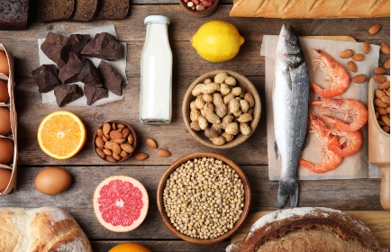 an array of foods including nuts, chocolate, dairy and fish that may be allergens